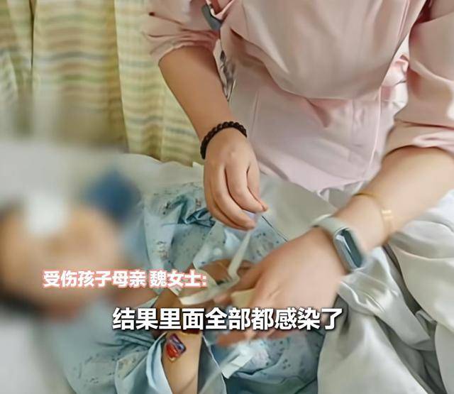 江西一5岁男孩在幼儿园被戳伤致左眼失明<strong></p>
<p>币安币交易所</strong>,家长称老师用猪油涂抹试图消肿