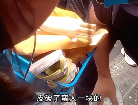 看着都疼<strong></p>
<p>艾达币交易所</strong>!上海街头一男子突然求助:10岁女儿被死死卡住!这个行为太危险→