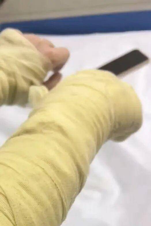 湖南一女主播被伪装的包裹炸伤<strong></p>
<p>艾达币交易所</strong>,永州公安:正在核实具体情况