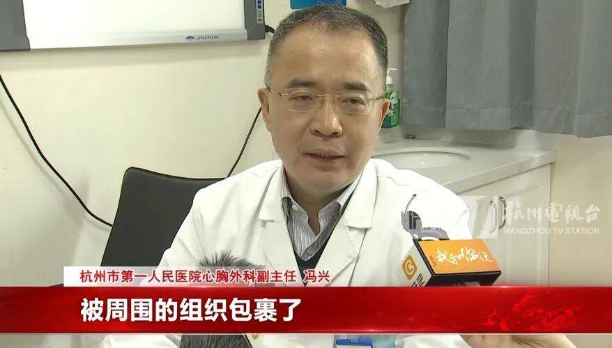 17岁小伙参军体检发现胸腔内有根5cm缝衣针<strong></p>
<p>古德币</strong>，父母回忆或是1岁时扎入，取出时已锈迹斑斑